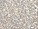 Immunohistochemistry of paraffin-embedded Human tonsil tissue using MAGEA1 Polyclonal Antibody at dilution of 1:65(×200)