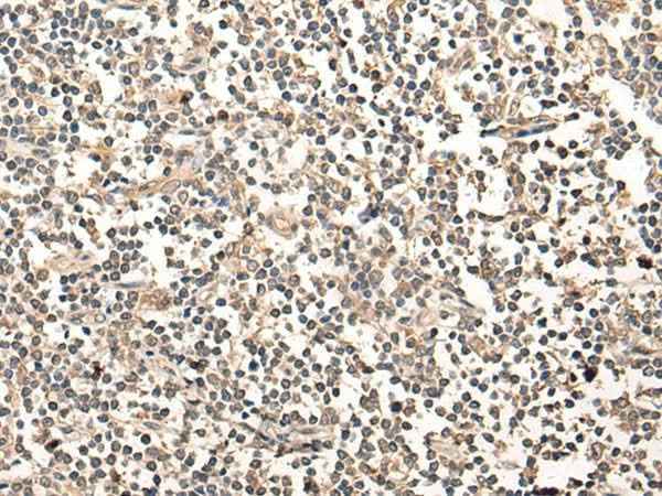 Anti-Human MAGEA1 Antibody