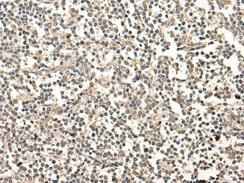 Immunohistochemistry of paraffin-embedded Human tonsil tissue using MAGEA1 Polyclonal Antibody at dilution of 1:65(×200)