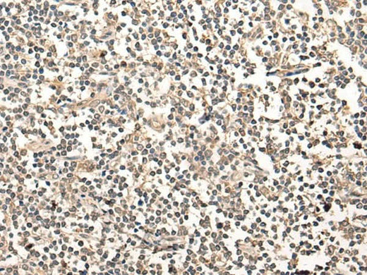 Immunohistochemistry of paraffin-embedded Human tonsil tissue using MAGEA1 Polyclonal Antibody at dilution of 1:65(×200)