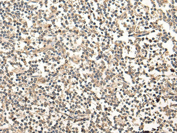 Immunohistochemistry of paraffin-embedded Human tonsil tissue using MAGEA1 Polyclonal Antibody at dilution of 1:65(×200)