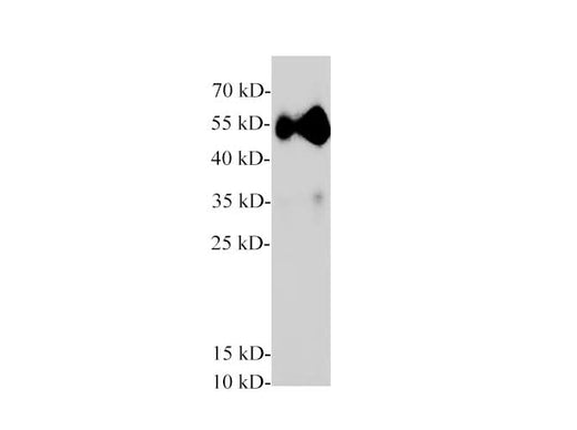 Western blot of Mouse pancreas with anti-Pancreatic lipase polyclonal antibody at 1:2000 dilution.