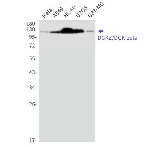 Western blot detection of DGKZ/DGK-zeta in Hela,A549,HL-60,U2OS,U87-MG cell lysates using DGKZ/DGK-zeta Rabbit mAb(1:1000 diluted).Predicted band size:104kDa.Observed band size:124,114kDa.