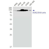 Western blot detection of DGKZ/DGK-zeta in Hela,A549,HL-60,U2OS,U87-MG cell lysates using DGKZ/DGK-zeta Rabbit mAb(1:1000 diluted).Predicted band size:104kDa.Observed band size:124,114kDa.