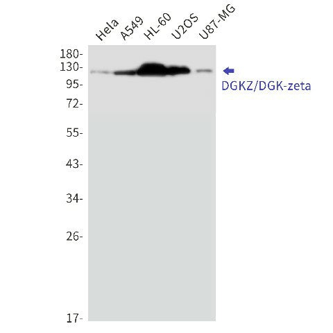 Western blot detection of DGKZ/DGK-zeta in Hela,A549,HL-60,U2OS,U87-MG cell lysates using DGKZ/DGK-zeta Rabbit mAb(1:1000 diluted).Predicted band size:104kDa.Observed band size:124,114kDa.
