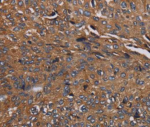 Anti-Human/Mouse/Rat HYAL2 Antibody