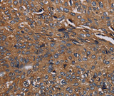 Anti-Human/Mouse/Rat HYAL2 Antibody - ABMIUM