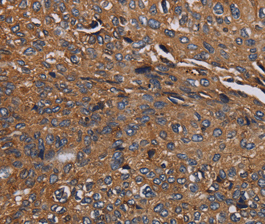 Anti-Human/Mouse/Rat HYAL2 Antibody - ABMIUM