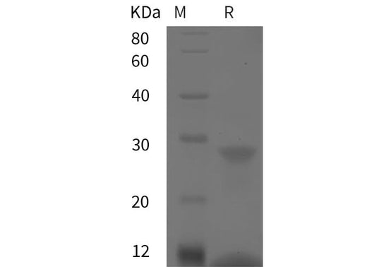 SDS-PAGE analysis of Porcine S100A12 proteins, 2 μg/lane of Recombinant Porcine S100A12 proteins was resolved with SDS-PAGE under reducing conditions, showing bands at 12 kDa.