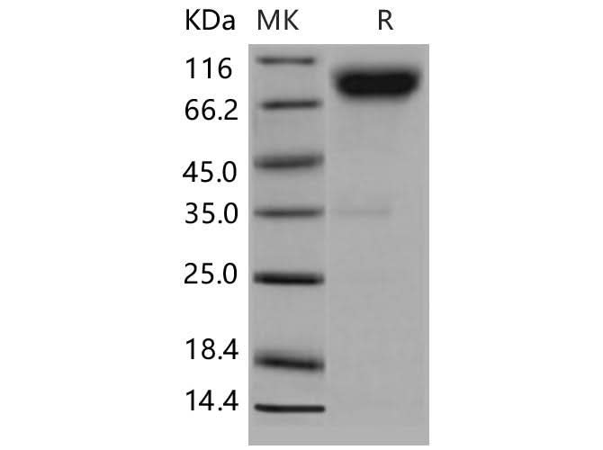 > 94 % as determined by reducing SDS-PAGE.