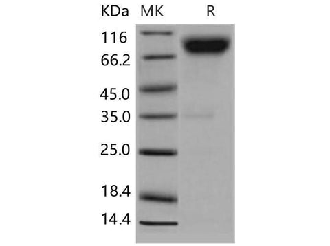 > 94 % as determined by reducing SDS-PAGE.