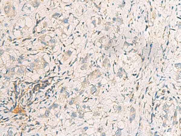 Anti-Human SUSD3 Antibody