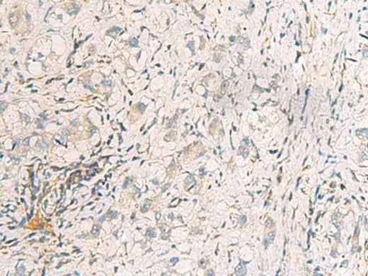 Anti-Human SUSD3 Antibody