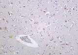 Anti-Human/Mouse/Rat PKD1 Antibody [B1034]