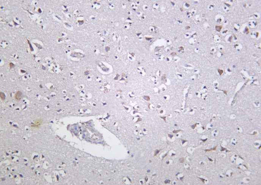 Anti-Human/Mouse/Rat PKD1 Antibody [B1034] - ABMIUM