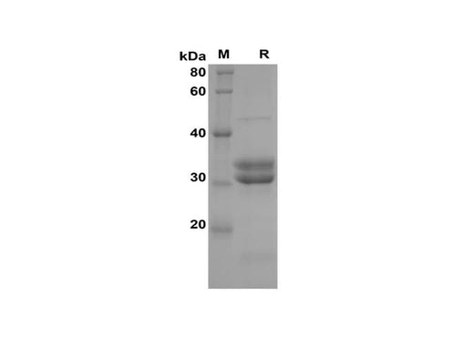 SDS-PAGE analysis of Human IL-15 proteins, 2 μg/lane of Recombinant Human IL-15 proteins was resolved with SDS-PAGE under reducing conditions, showing bands at 32 kDa.