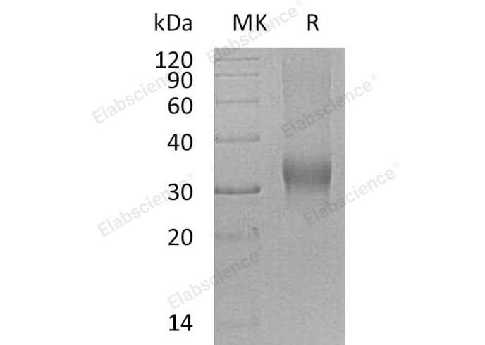 Recombinant Human PRG2/BMPG Protein (His Tag) - ABMIUM