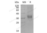 Recombinant Human PRG2/BMPG Protein (His Tag) - ABMIUM