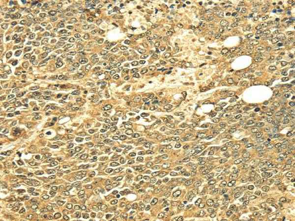 Anti-Human/Mouse ECE2 Antibody