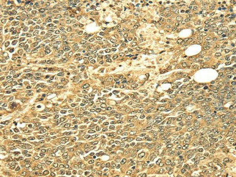 Anti-Human/Mouse ECE2 Antibody - ABMIUM