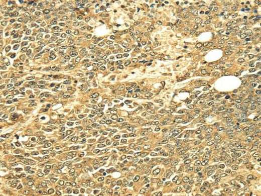 Anti-Human/Mouse ECE2 Antibody - ABMIUM
