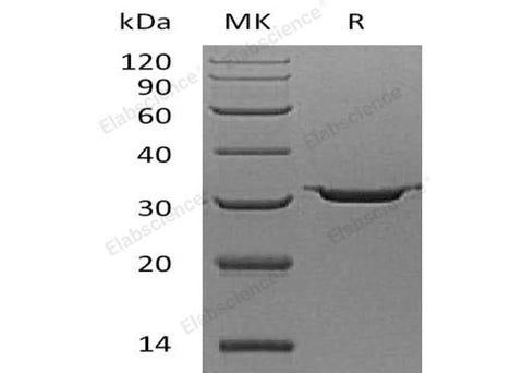 Recombinant Human Carbonic Anhydrase 7/CA7 Protein (His Tag) - ABMIUM