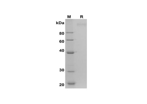 SDS-PAGE analysis of Human IGF1R proteins, 2 μg/lane of Recombinant Human IGF1R proteins was resolved with SDS-PAGE under reducing conditions, showing bands at 110 kDa.