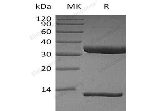 Recombinant Human FcRn & B2M Heterodimer Protein (His Tag) - ABMIUM