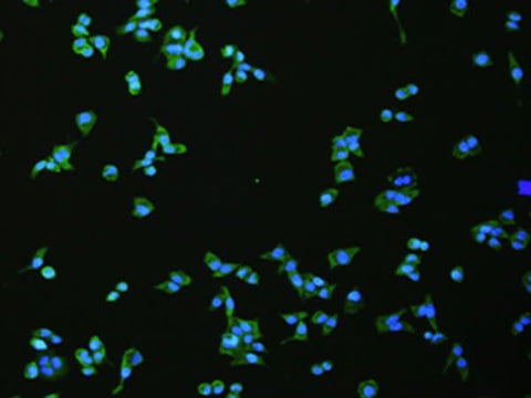 Immunofluorescence analysis of hela cell using FLT4 Polyclonal Antibody at dilution of 1:100