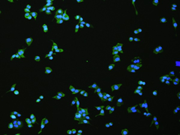Immunofluorescence analysis of hela cell using FLT4 Polyclonal Antibody at dilution of 1:100