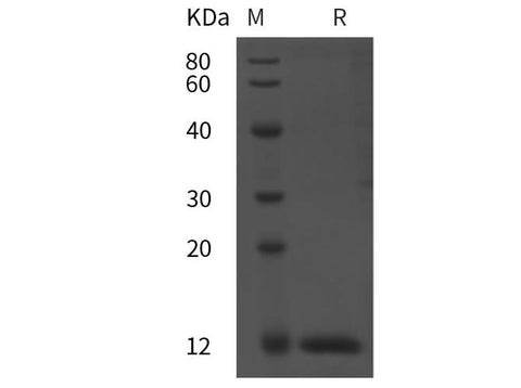 SDS-PAGE analysis of Rat BMG/β2-MG proteins, 2 μg/lane of Recombinant Rat BMG/β2-MG proteins was resolved with SDS-PAGE under reducing conditions, showing bands at 12 kDa.