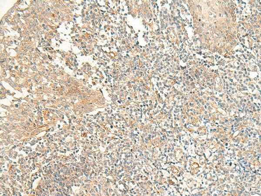 Anti-Human/Mouse/Rat PTGDR2 Antibody
