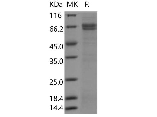 Recombinant Human SUSD4/Sushi domain-containing protein 4 Protein (Fc Tag) - ABMIUM