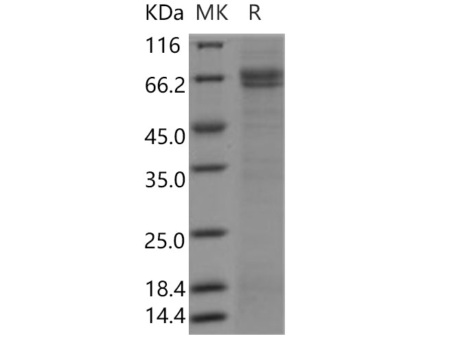 Recombinant Human SUSD4/Sushi domain-containing protein 4 Protein (Fc Tag) - ABMIUM