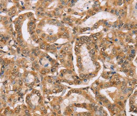 Anti-Human BGLAP Antibody