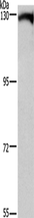 Anti-Human/Mouse DAAM1 Antibody - ABMIUM