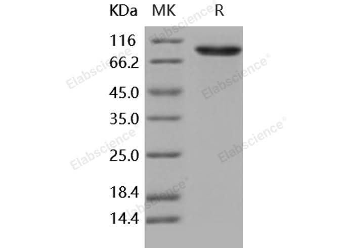 Recombinant Human DDR2 Kinase/CD167b Protein (Fc Tag) - ABMIUM