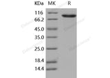 Recombinant Human DDR2 Kinase/CD167b Protein (Fc Tag) - ABMIUM