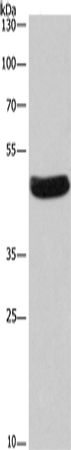 Anti-Human/Mouse/Rat SEPT7 Antibody - ABMIUM