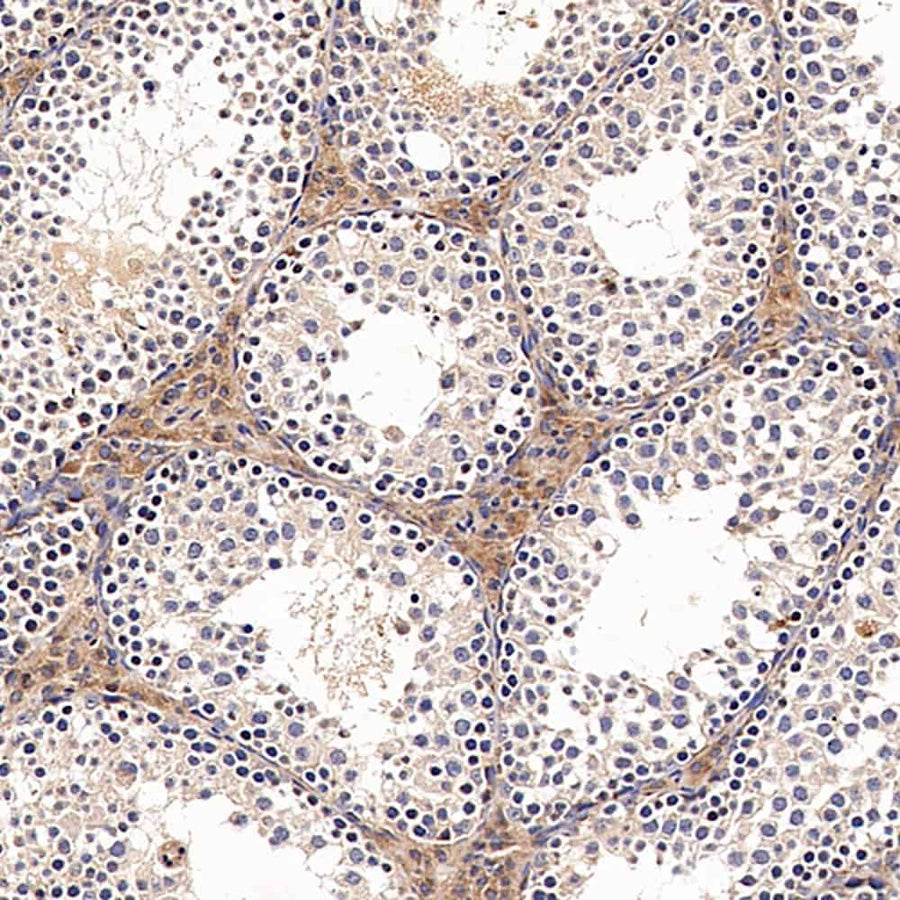 Immunohistochemistry analysis of paraffin-embedded Rat testis using ACE1 Polyclonal Antibody at dilution of 1:300.