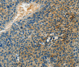 Anti-Human/Mouse/Rat DGKB Antibody - ABMIUM