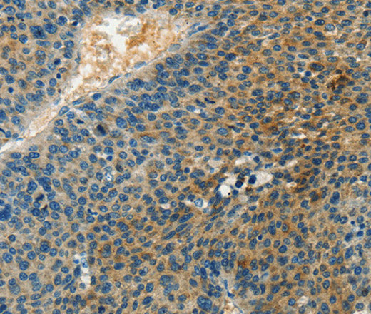 Anti-Human/Mouse/Rat DGKB Antibody - ABMIUM