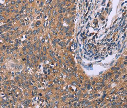 Anti-Human IL3RB Antibody