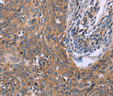 Anti-Human IL3RB Antibody - ABMIUM