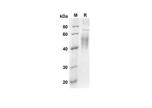 SDS-PAGE analysis of Mouse CD80/B7-1 proteins, 2 μg/lane of Recombinant Mouse CD80/B7-1 proteins was resolved with an SDS-PAGE under reducing conditions, showing bands at 22.8 kDa.