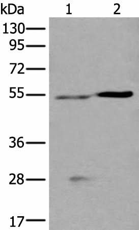 Western blot analysis of Human left kidney tissue and Human fetal liver tissue lysates using DDC Polyclonal Antibody at dilution of 1:400
