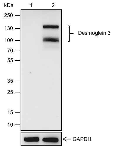 Anti-Human Desmoglein 3/PVA Antibody [A614]