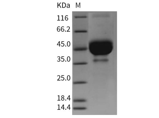 Recombinant Mouse TETHERIN/BST2 Protein (Fc Tag) - ABMIUM
