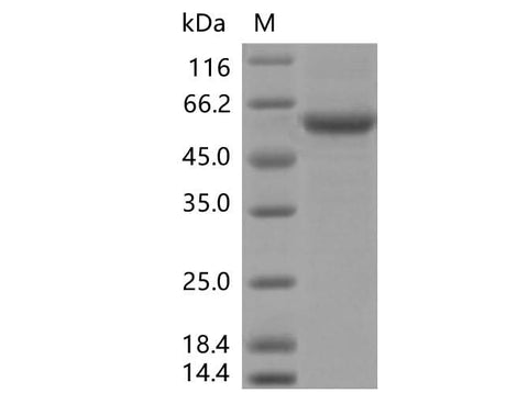 Recombinant SARS-CoV-2 Spike RBD (K417N, E484K, N501Y)(rFc Tag) - ABMIUM