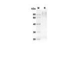 SDS-PAGE analysis of Mouse Csf1r proteins, 2 μg/lane of Recombinant Mouse Csf1r proteins was resolved with an SDS-PAGE under reducing conditions, showing bands at 54.4 kDa.